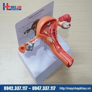 Mô hình tử cung buồng trứng âm đạo bệnh lý