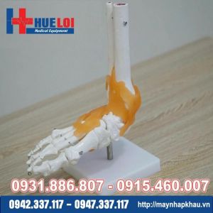 Mô Hình Khớp Cổ Chân