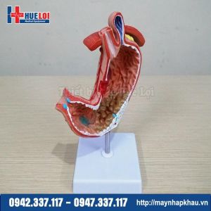 Mô hình các bệnh lý dạ dày
