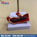 Mô hình biến chứng của bệnh tăng huyết áp