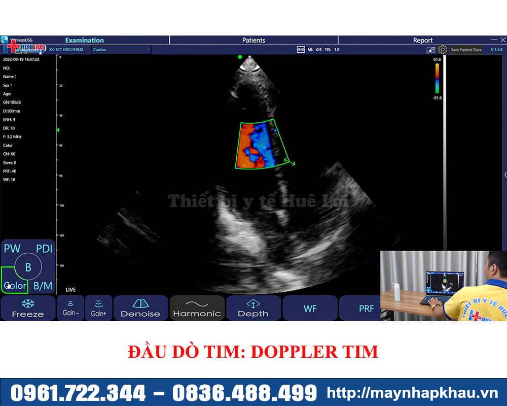 hình ảnh doppler tim